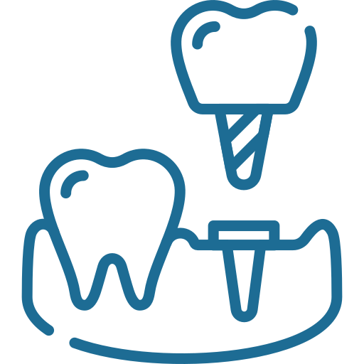 Dental Implant