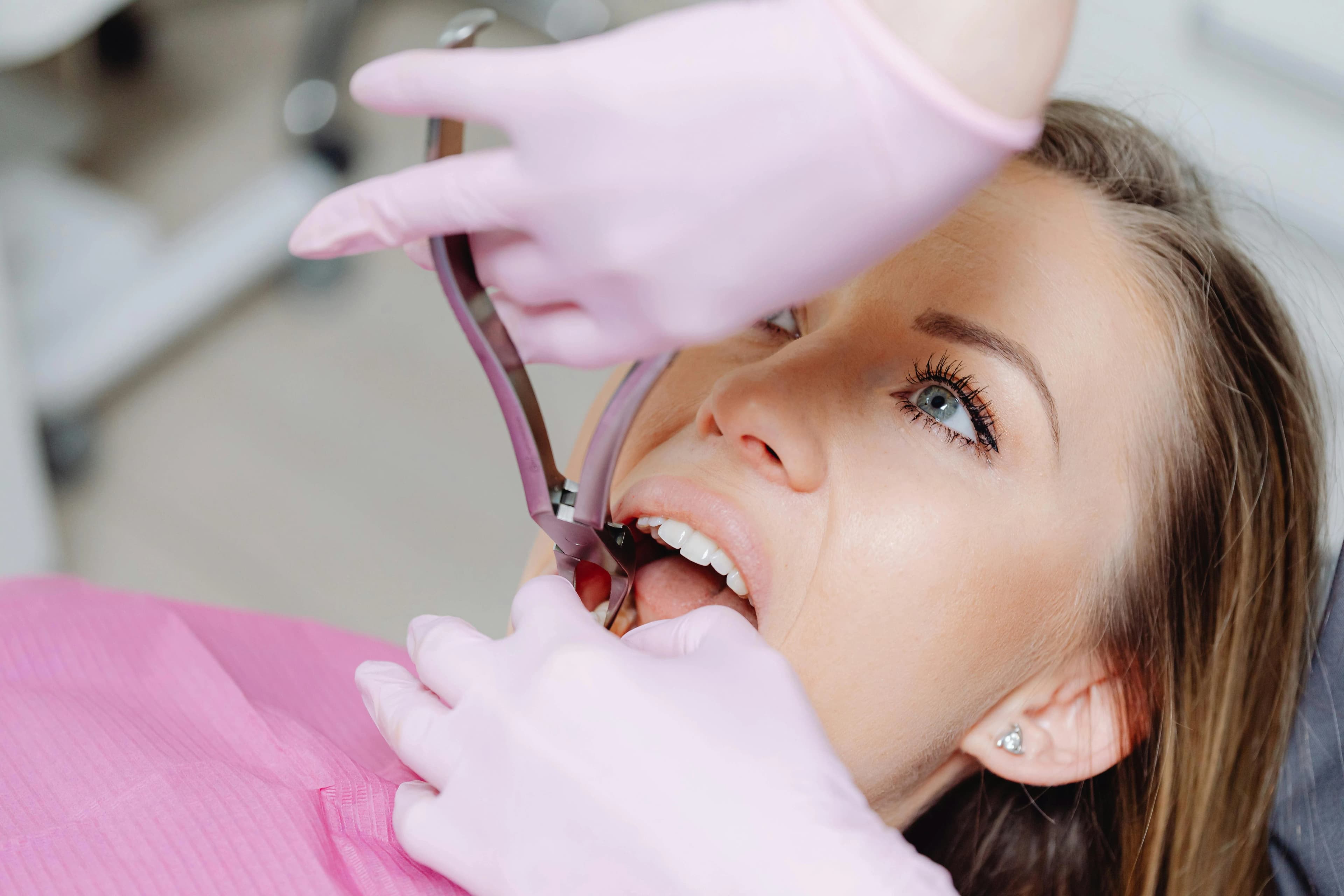 Tooth Extraction