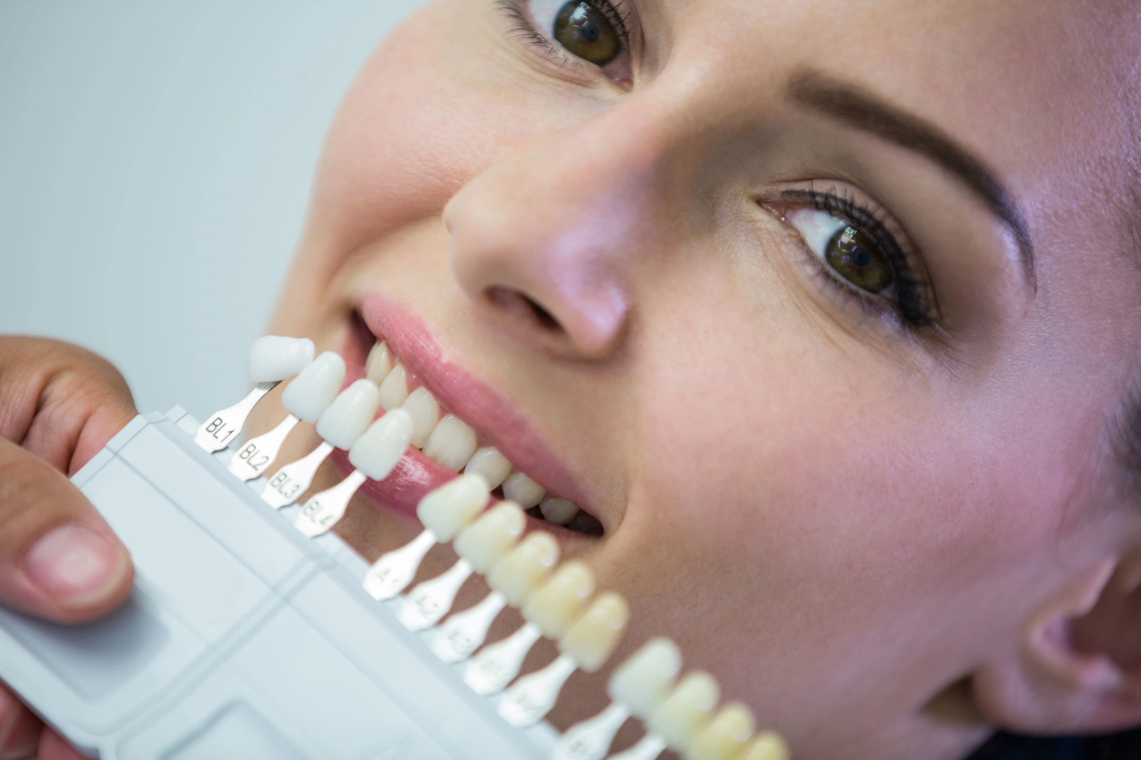 Whitening & Veneers